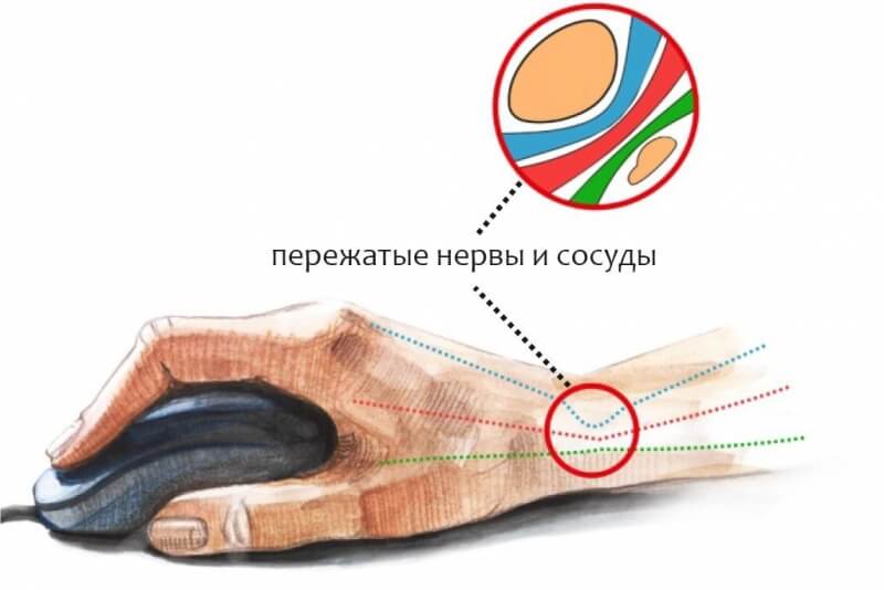 Кракен маркет даркнет слушать